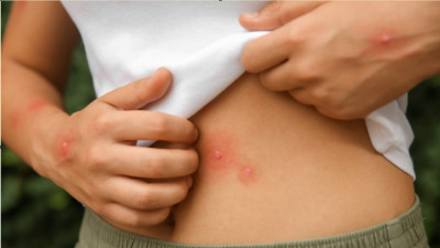 Imagem ilustrativa: Infestação de mosquitos em zona litoral do concelho de Torres Vedras